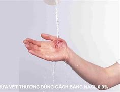 Rửa Vết Thương Sạch